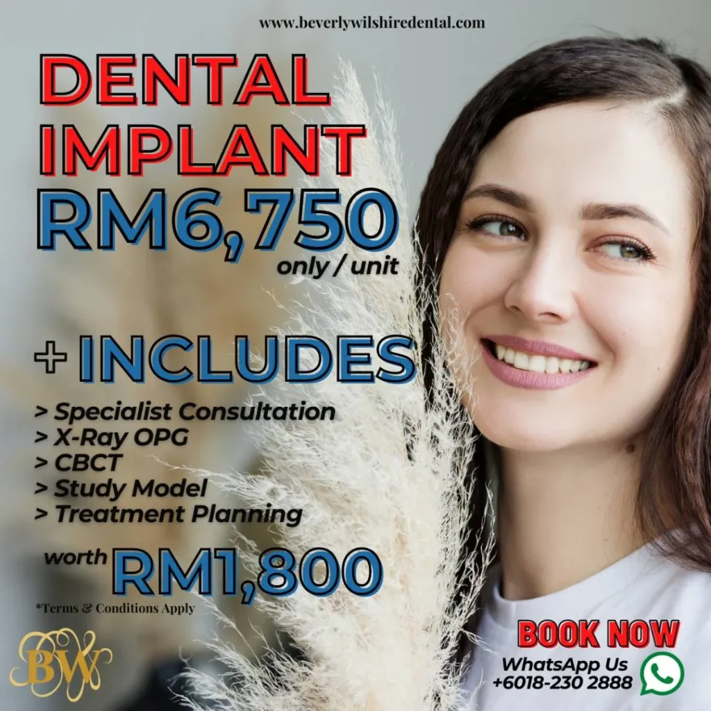 Dental implant marketing campaign poster