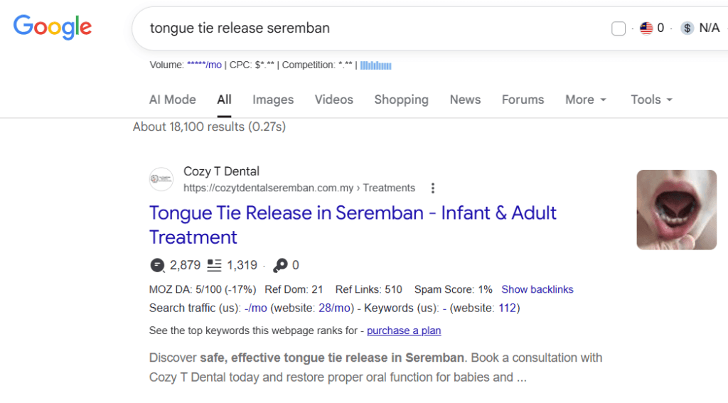 google serp result of tongue tie release seremban