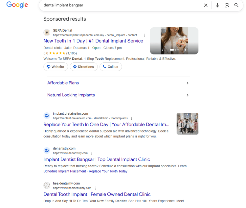 Screenshot of a Google search results page for the query “dental implant bangsar.” The page displays sponsored results at the top, including ads for dental implant clinics such as SEPA Dental, implant.drelainelim.com, denatistry.com, and healdentalmy.com. The first sponsored listing features ratings, location details, business hours, and action buttons for Website, Directions, and Call. Additional ad sections promote affordable plans and natural-looking implants. The interface includes the Google search bar at the top and thumbnail images beside some listings.